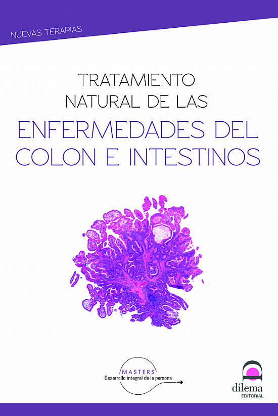 Tratamiento natural de las enfermedades del colon e intestinos